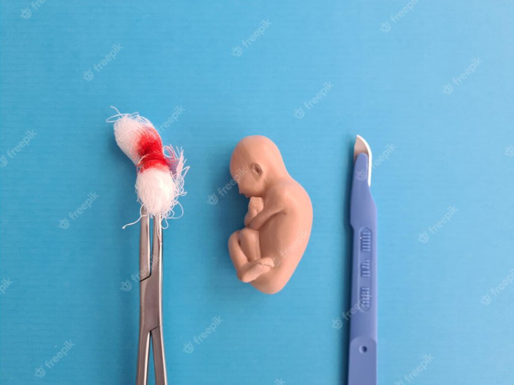 Aborcja w Polsce
